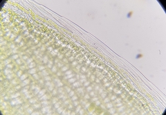 Sphagnum denticulatum