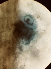 Stentor coeruleus