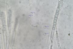 Pulvinula archeri