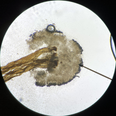 Chaenotheca gracilenta