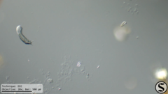 Heterolepidoderma
