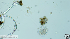 Vorticella campanula