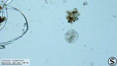 Vorticella campanula