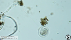 Vorticella campanula