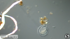 Vorticella campanula