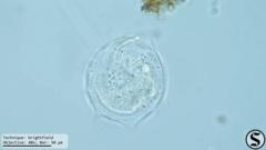 Vorticella campanula