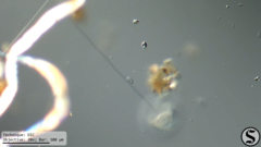 Vorticella campanula