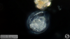 Vorticella campanula