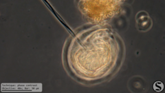 Vorticella campanula