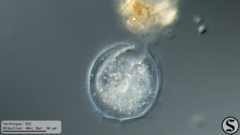 Vorticella campanula