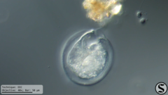 Vorticella campanula