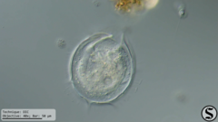 Vorticella campanula