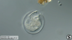 Vorticella campanula