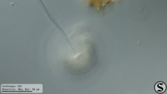 Vorticella campanula