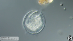 Vorticella campanula