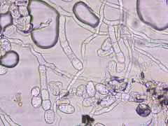 Podosphaera erigerontis-canadensis