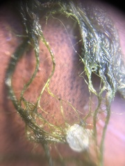 Hydrodictyon reticulatum