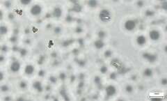 Lycoperdaceae