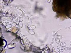 Podosphaera erigerontis-canadensis