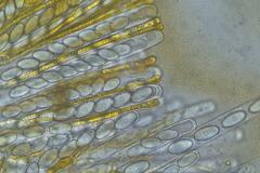 Cheilymenia coprinaria