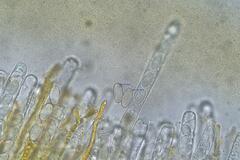 Cheilymenia coprinaria