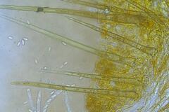 Cheilymenia coprinaria