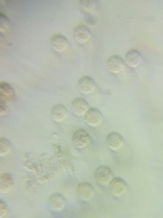 Lycogala exiguum