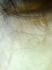 Lycogala exiguum