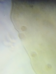 Lycogala exiguum