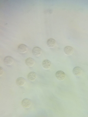 Lycogala exiguum