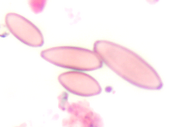 Cladosporium herbarum