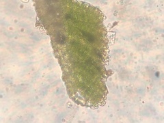 Polytrichum pallidisetum