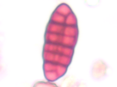 Pleospora valesiaca