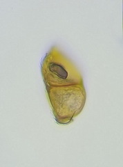Puccinia allii