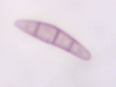 Leptosphaeria