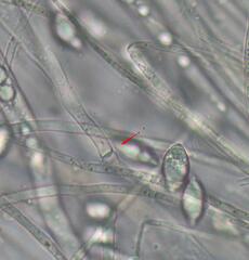 Phaeohelotium undulatum