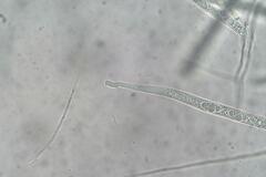 Phaeohelotium undulatum