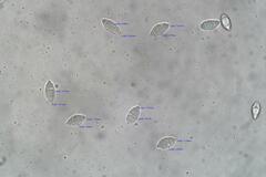 Phaeohelotium undulatum