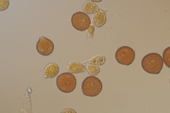 Puccinia hydrocotyles