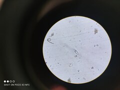 Planktothrix rubescens