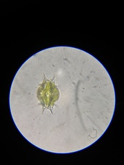 Xanthidium antilopaeum polymazum