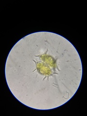 Xanthidium antilopaeum polymazum