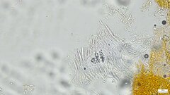 Hypomyces subiculosus