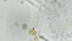 Hypomyces subiculosus