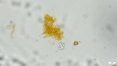 Hypomyces subiculosus