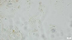 Hypomyces subiculosus