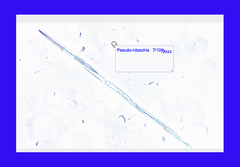 Pseudo-nitzschia pungens