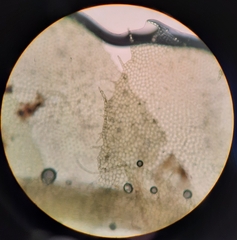 Chiloscyphus villosus