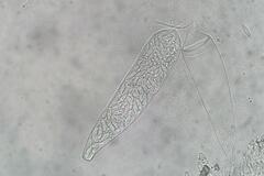 Ascozonus woolhopensis
