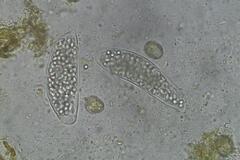 Coprotus